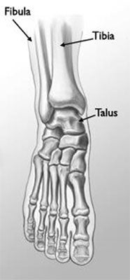 Ankle Fractures in Children | Pediatrics – Orthopedic Surgery | Boston